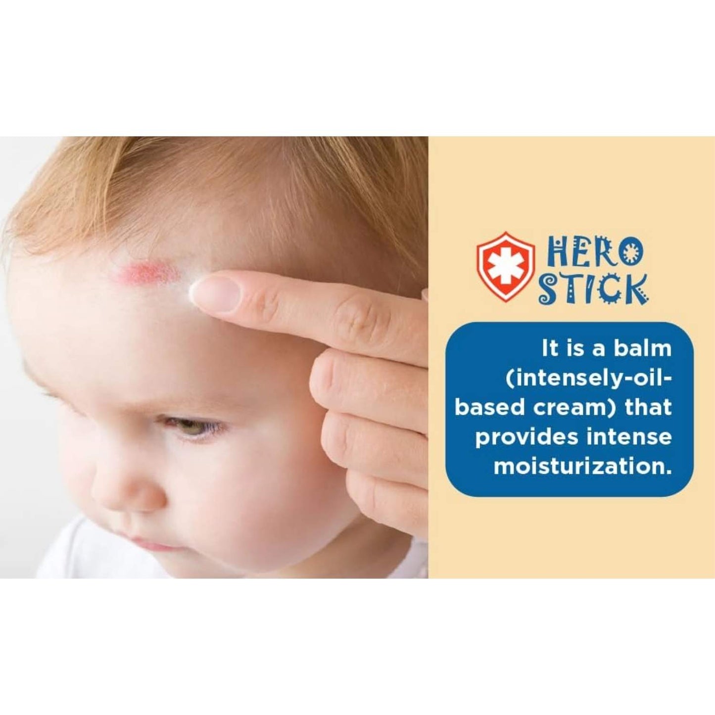 El Hero Stick de Babyton es el bálsamo imprescindible en el botiquín de cualquier familia. Este bálsamo calmante en formato barra ha sido específicamente diseñado para tratar las aventuras diarias de bebés y niños. Gracias a su fórmula 100% natural, libre de alcohol, perfumes y parabenos, es perfecto para aplicar sobre la piel sensible ante picaduras de insectos, chichones o zonas de sequedad extrema como labios agrietados, irritaciones y eccemas leves. Su combinación de aceite de girasol y Vitamina E nutre