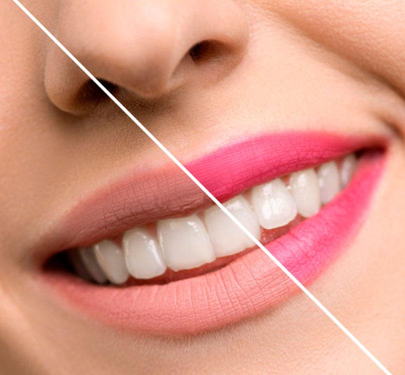 efecto de color del labial mágico nuestro labial con flores reales y aroma a fresa! Este labial tiene un poder especial para ti: ¡se adapta al pH de tus labios y les da un tono rosado perfecto y único!